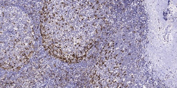 EphB4 antibody