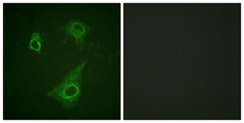 EpoR (phospho Tyr368) rabbit pAb