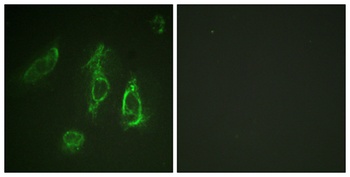 EpoR antibody