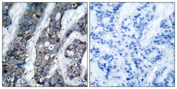 Neu (phospho-Tyr1248) antibody