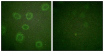 Neu (phospho Thr686) rabbit pAb