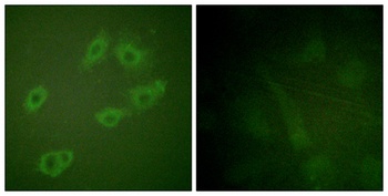 ErbB-3 (phospho Tyr1222) rabbit pAb