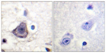 ErbB-3 (phospho Tyr1222) rabbit pAb