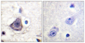 ErbB-3 (phospho-Tyr1222) antibody