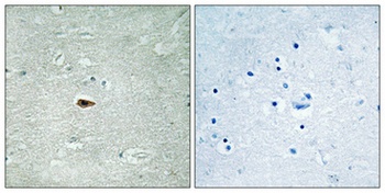 ErbB-3 (phospho Tyr1328) rabbit pAb