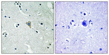 ErbB-3 (phospho Tyr1328) rabbit pAb