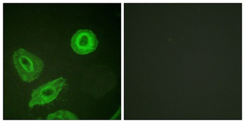 ErbB-3 (phospho Tyr1289) rabbit pAb