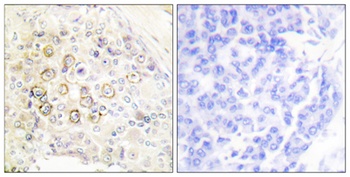 ErbB-3 rabbit pAb Antibody