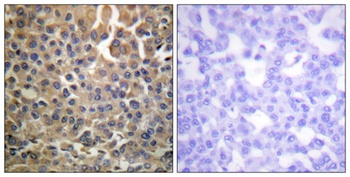 ErbB-4 (phospho Tyr1284) rabbit pAb