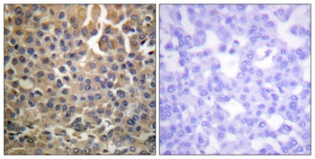 ErbB-4 (phospho-Tyr1284) antibody