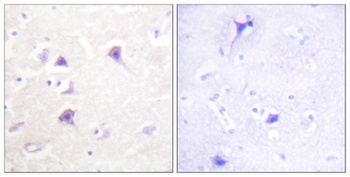 ErbB-4 rabbit pAb