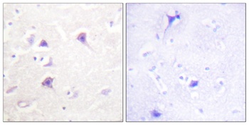 ErbB-4 antibody