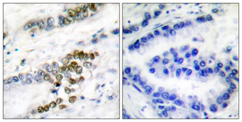 ERCC1 antibody