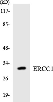 ERCC1 rabbit pAb