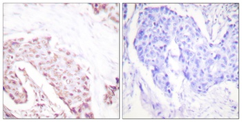 Akt (phospho Ser124) rabbit pAb