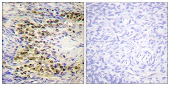 Akt1 (phospho Thr72) rabbit pAb