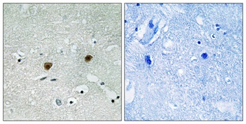 Akt (phospho Tyr315) rabbit pAb