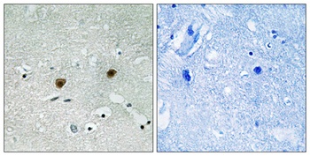 Akt (phospho-Tyr315) antibody