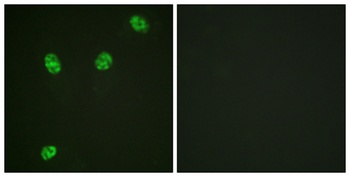 ERF (phospho Thr526) rabbit pAb