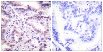 ERF (phospho Thr526) rabbit pAb