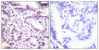 ERF (phospho-Thr526) antibody