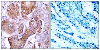 ER alpha (phospho-Ser106) antibody