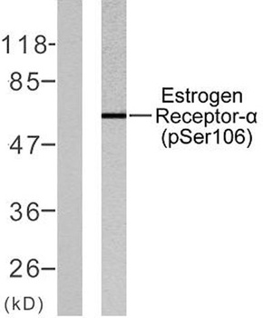 ER alpha (phospho-Ser106) antibody