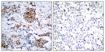 ERα (phospho Ser167) rabbit pAb