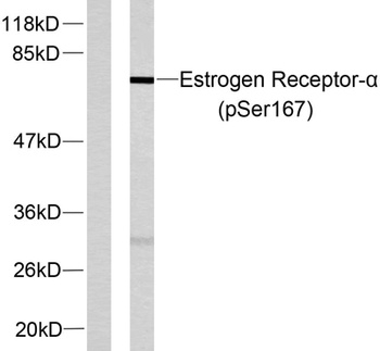 ERα (phospho Ser167) rabbit pAb