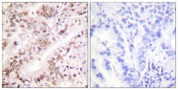 ER alpha (phospho-Tyr537) antibody