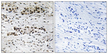 ERα (phospho Ser102) rabbit pAb