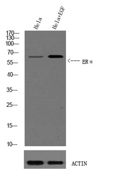 ER alpha (phospho-Ser102) antibody