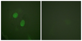 ERα (phospho Ser305) rabbit pAb