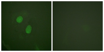 ER alpha (phospho-Ser305) antibody