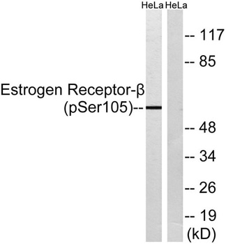 ER beta (phospho-Ser105) antibody