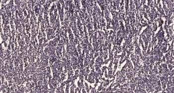 Ets-1 (phospho Ser251) rabbit pAb