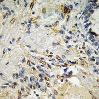 ETS1 antibody