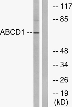 ABCD1 rabbit pAb