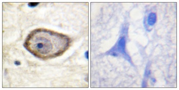 TF (phospho Ser290) rabbit pAb