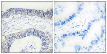 Cleaved-Factor XII HC (I20) rabbit pAb