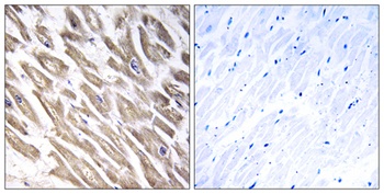 Factor XIII B antibody