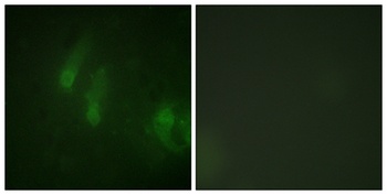 FANCA (phospho-Ser1149) antibody