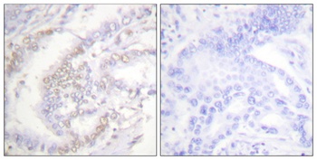 FANCD2 (phospho Ser222) rabbit pAb
