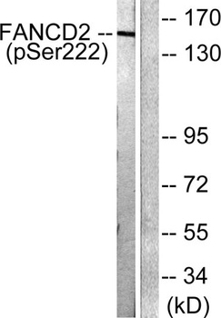 FANCD2 (phospho-Ser222) antibody