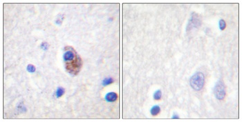 PYK2 (phospho-Tyr881) antibody