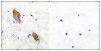 PYK2 (phospho Tyr881) rabbit pAb