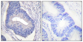 PYK2 (phospho-Tyr580) antibody