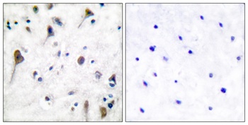 PYK2 (phospho-Tyr580) antibody