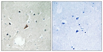 PYK2 (phospho Tyr579) rabbit pAb