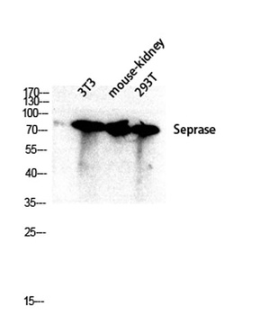 Seprase antibody